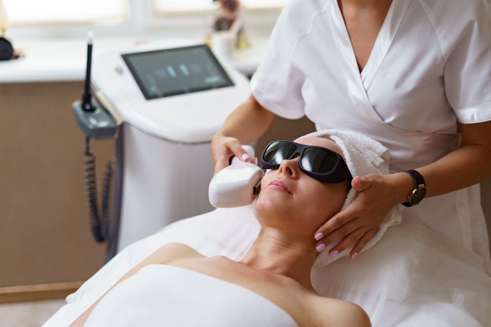 IPL Photofacial University Place, WA