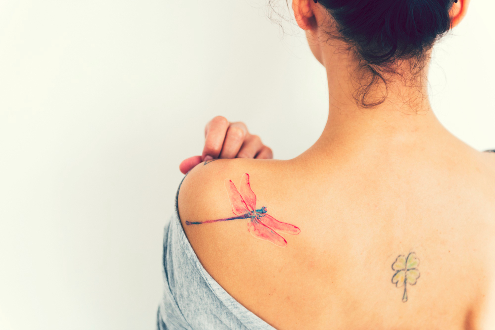 Tattoo Removal University Place, WA